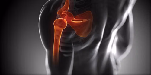 Eoin O'Conaire The Shoulder Masterclass. An evidence-based approach