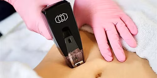 Sculpt without Surgery