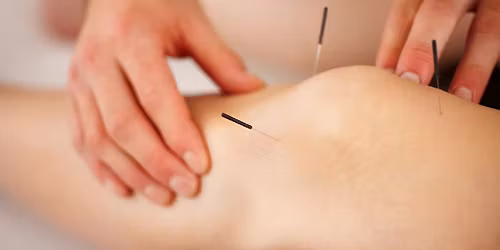 Treating musculoskeletal conditions: Integrating East & West - with Alex Brazkiewicz [3 day CPD]