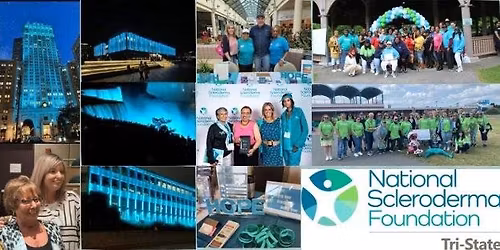 Stepping Out to Cure Scleroderma Binghamton