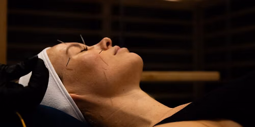 Acupuncture in Spa @ Q