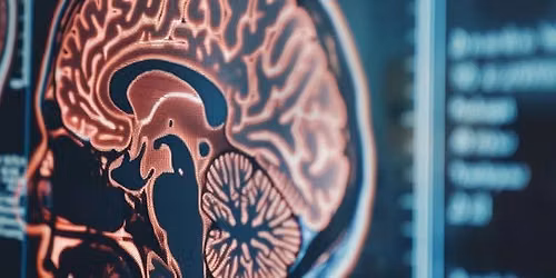 Empowering the Aging Brain Presented by Hoag