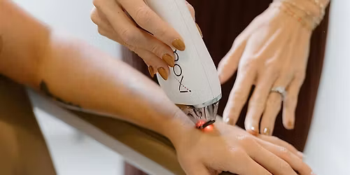 Fall Laser Event at Self Skin Studio in Wilmington, NC