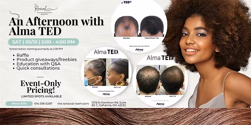 An Afternoon with Aluma TED