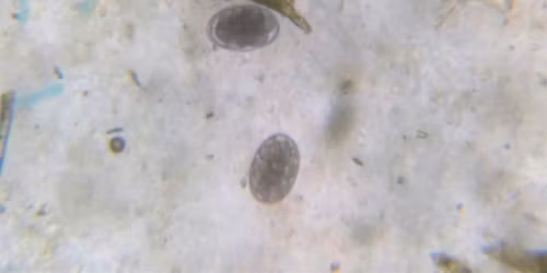 Fecal Egg Counting , Davie County