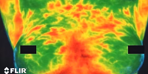 Thermography Imaging day!