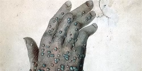 WALKING TOUR! To vax or not to vax: smallpox in early Boston