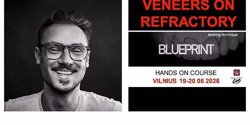 MDT Patrick Heidt | VENEERS ON REFRACTORY