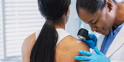 Free Skin Cancer Screening - Lynchburg