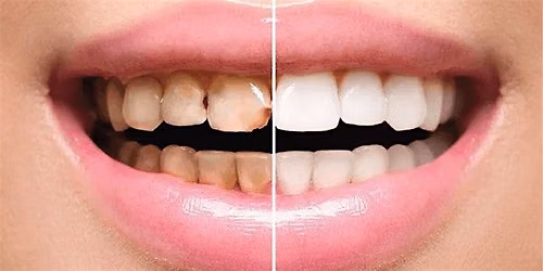 Study Circle - Dental Restorative Level 4