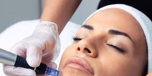 Tratamiento Especial Navidad: 2 sesiones de Dermapen + Exosomas