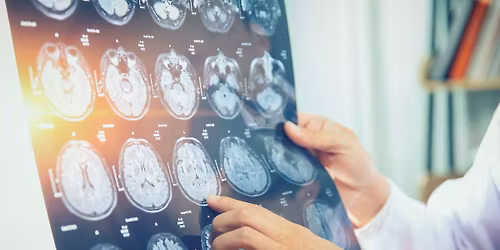 Advancing the Science: The Latest in Alzheimer\u2019s and Dementia Research