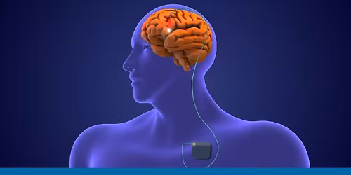 MDS-AOS School for Device Aided Therapies in Parkinson\u2019s Disease