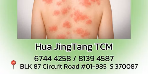\ud83c\udf3f \u6e7f\u75b9\u95ee\u9898  \u514d\u8d39\u54a8\u8be2 \ud83c\udf3f Free Eczema Advice Session\ud83c\udf3f      