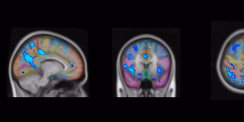 The Neurophenomenology of Surrender. Dr. Josh Brahinsky