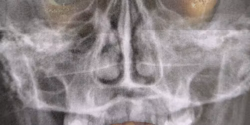 Erwan COUTANT + guests au TNT