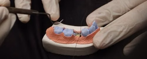 ATRAUMATIC EXTRACTION AND RIDGE PRESERVATION