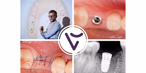 Kurs wprowadzaj\u0105cy do implantologii na podstawie systemu Thommen