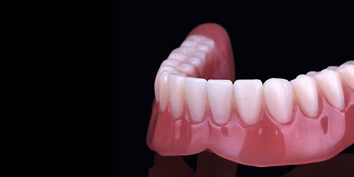 Modern Dentures, Modern Practice: Growing with Digital Denture Workflows