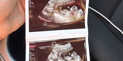 \ud83e\udd8bGender Reveal \ud83c\udf38