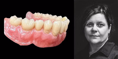 X\u2011Treme Aesthetics \u2013 Painting & Microlayering For Dental Prosthetics