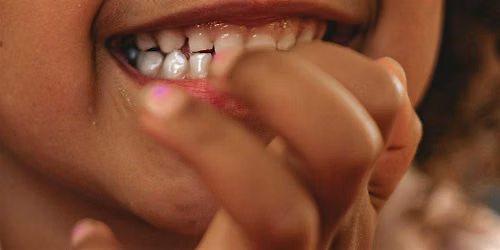 Free Kindergarten Oral Health Assessment