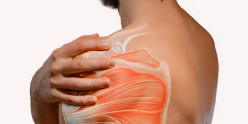 Shoulder Pain Workshop