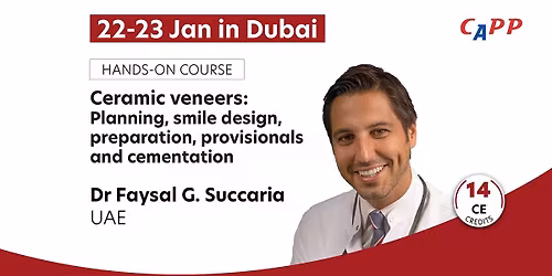 Ceramic veneers: Planning, smile design, preparation, provisionals and cementation