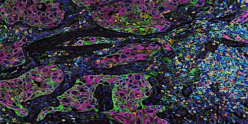 The Future of Personalised Medicine: Exploring King's new Smart Trials Hub