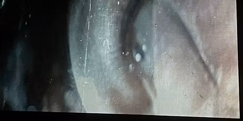 J\u00e4tepiste - nykynukketeatteriesitys