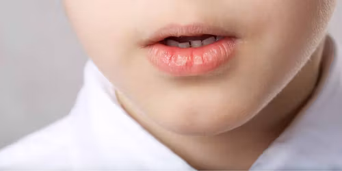 Terapia otwartej buzi u dzieci