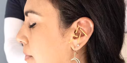 Acudetox Therapy Walk In Clinic \u2665\ufe0f