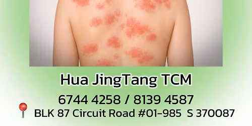 \ud83c\udf3f \u6e7f\u75b9\u95ee\u9898 \u514d\u8d39\u54a8\u8be2 \ud83c\udf3f Free Eczema Advice Session\ud83c\udf3f