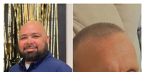 Bike an Coffee + Benefit Ride(Read Details)