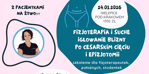 Fizjoterapia i Suche Ig\u0142owanie Blizny po Ci\u0119ciu Cesarskim i Epizjotomii