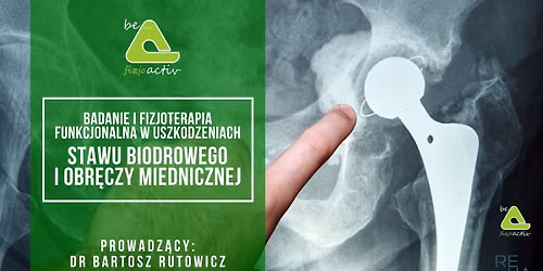 Badanie i fizjoterapia funkcjonalna w uszkodzeniach stawu biodrowego i obr\u0119czy miednicznej