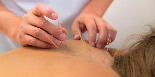 The Acupuncture Collective