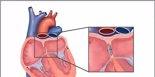 \ud83e\udd0d PFO, KARDIOLOGIE A BEZPE\u010cNOST V POT\u00c1P\u011aN\u00cd
