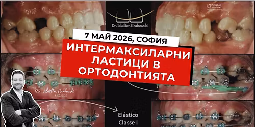 \u0418\u043d\u0442\u0435\u0440\u043c\u0430\u043a\u0441\u0438\u043b\u0430\u0440\u043d\u0438 \u043b\u0430\u0441\u0442\u0438\u0446\u0438 \u0432 \u043e\u0440\u0442\u043e\u0434\u043e\u043d\u0442\u0438\u044f\u0442\u0430 \u2013 \u0432\u0438\u0434\u043e\u0432\u0435, \u043f\u0440\u0438\u043b\u043e\u0436\u0435\u043d\u0438\u0435 \u0438 \u043a\u043b\u0438\u043d\u0438\u0447\u043d\u0438 \u0441\u0442\u0440\u0430\u0442\u0435\u0433\u0438\u0438