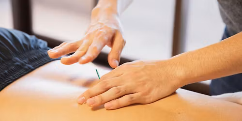 Acupuncture Practical Workshop