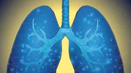 Pulmonary Fibrosis Tayside and Fife