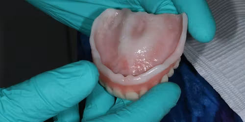 JANUARY DENTURE BOOTCAMP