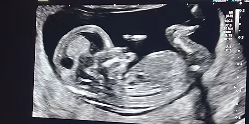 Skye babyshower\/gender reveal 