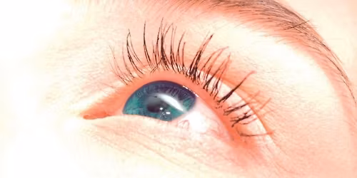 D\u00e9pistage gratuit du glaucome