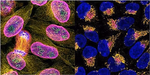 Immunofluorescence Workshop: Make your data glow!