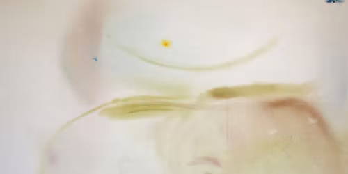 Yoga & Acupuncture | Set Your Intention