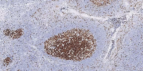 The Immunohistochemistry Network: North West Regional Meeting