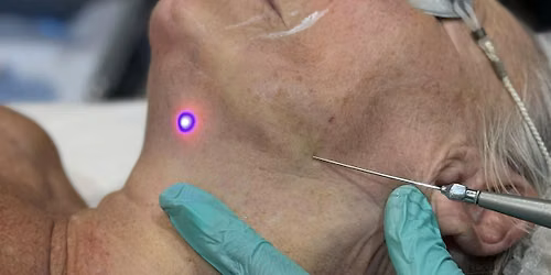 K-LASER BLUE CLINICAL APPLICATIONS MASTERCLASS (2ND NOV)