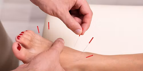 Podiatric Acupuncture