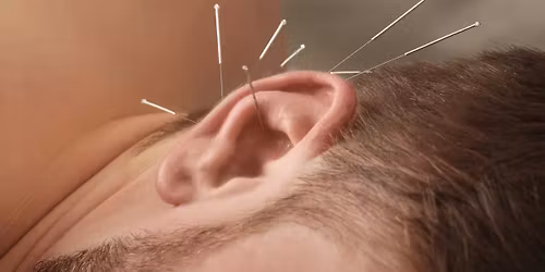 Find Some Stillness This Season: Acu-Detox, Yoga Nidra & Sound Bath